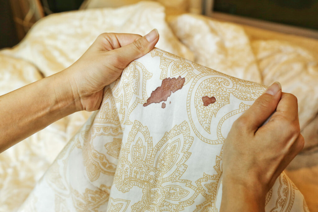 Easy steps to remove stains from bed sheets